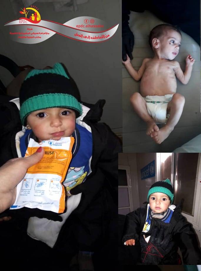 The Success story of little Sajida